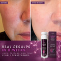 Ultimate Serum with Exosomes, Growth Factors & Peptides