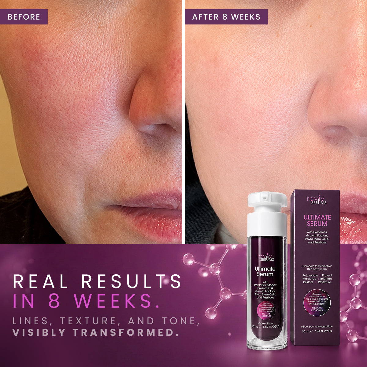 Ultimate Serum with Exosomes, Growth Factors & Peptides